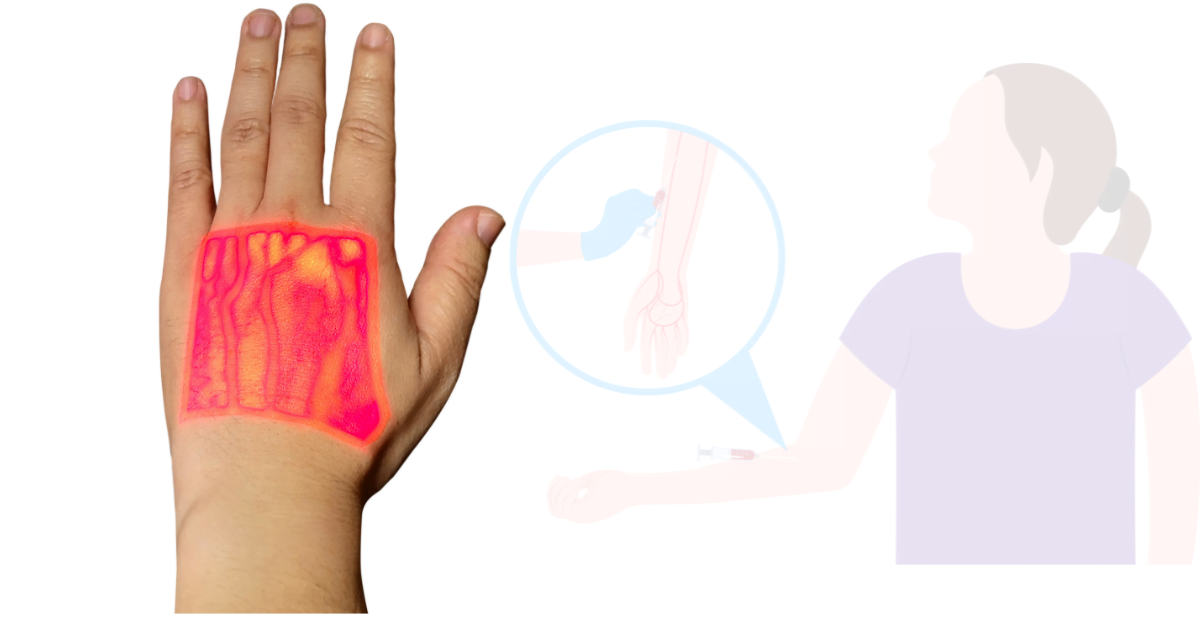 Cephalic Vein: Key Insights