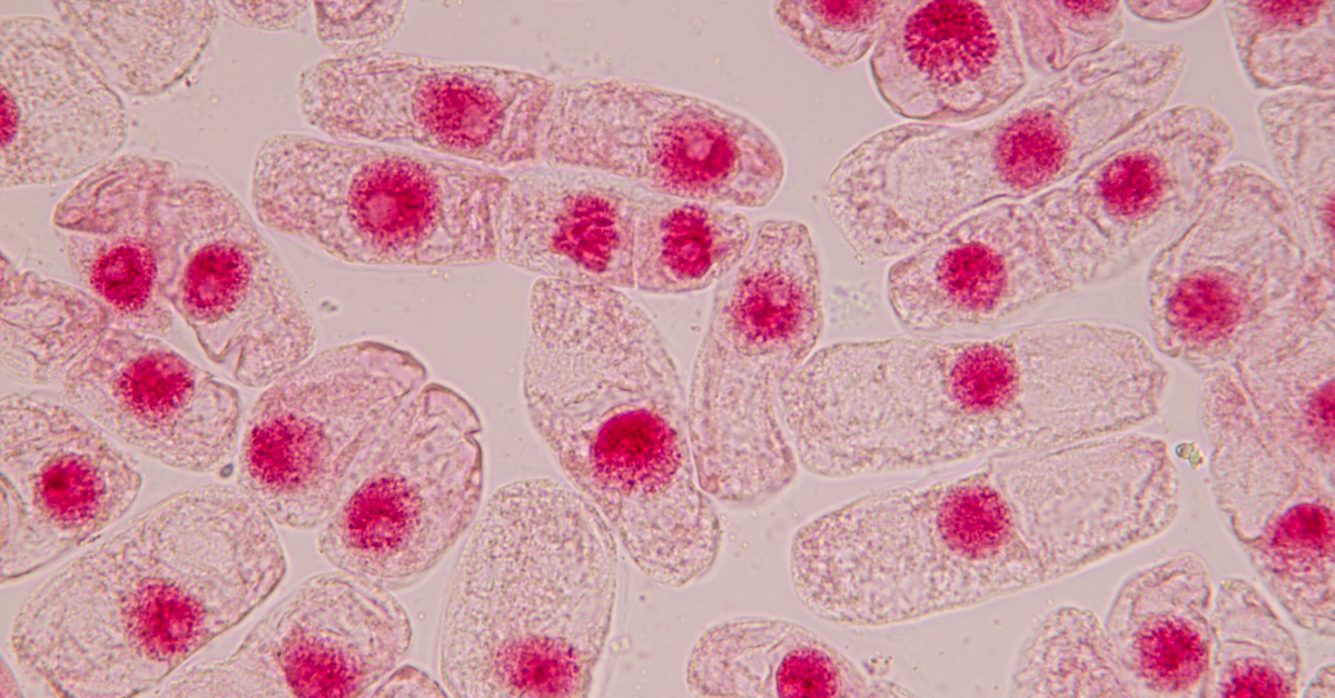 Cell Chromosomes: Haploid vs Diploid