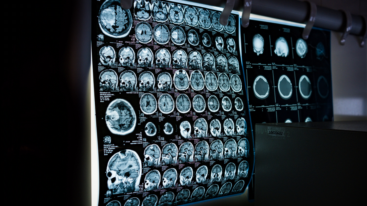 Open MRI: Future of Radiology
