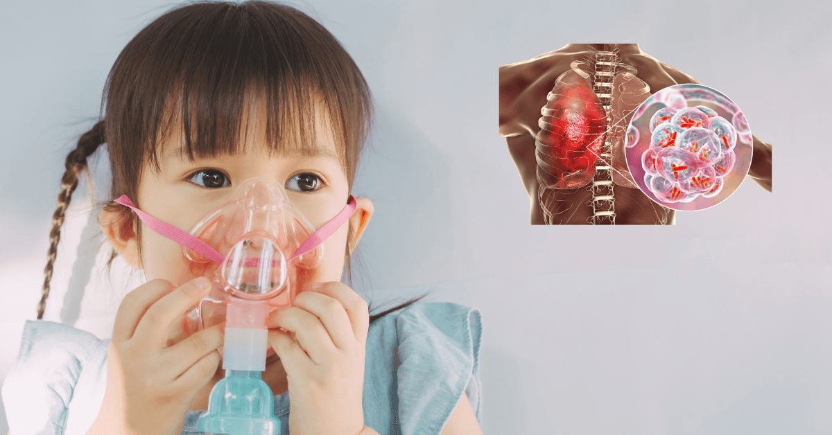 Rising Walking Pneumonia Cases Explained