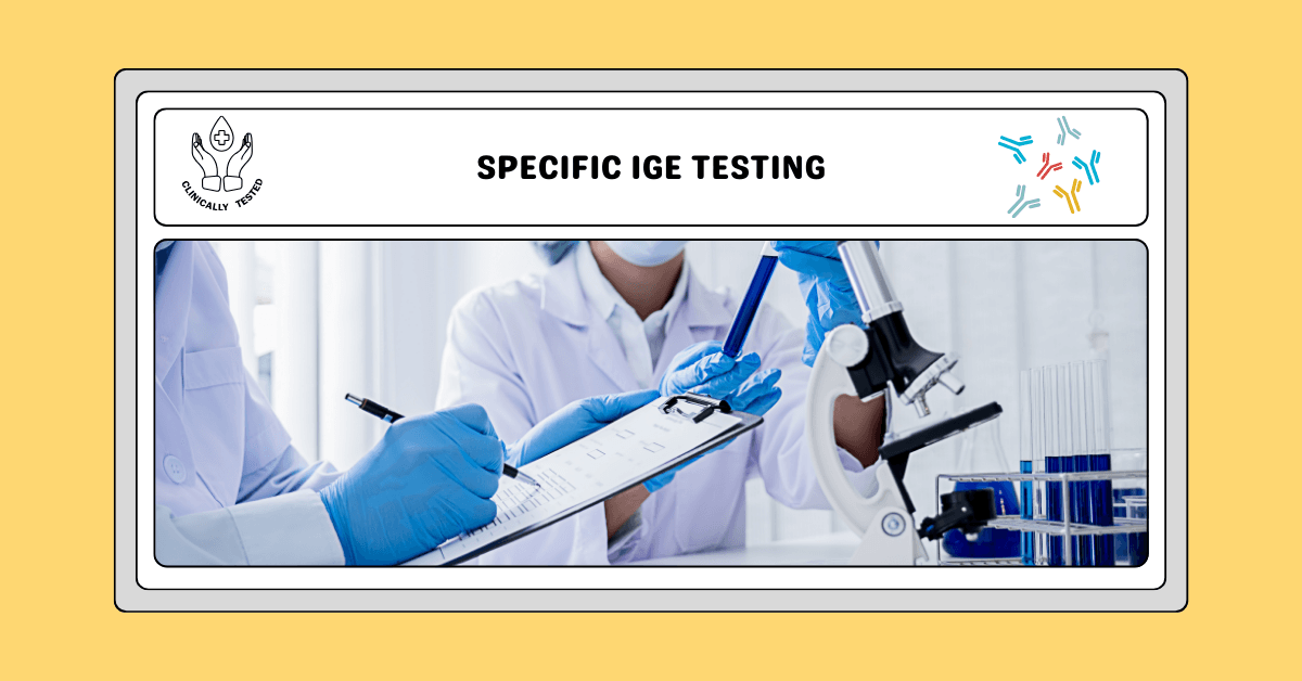 Specific IgE Testing