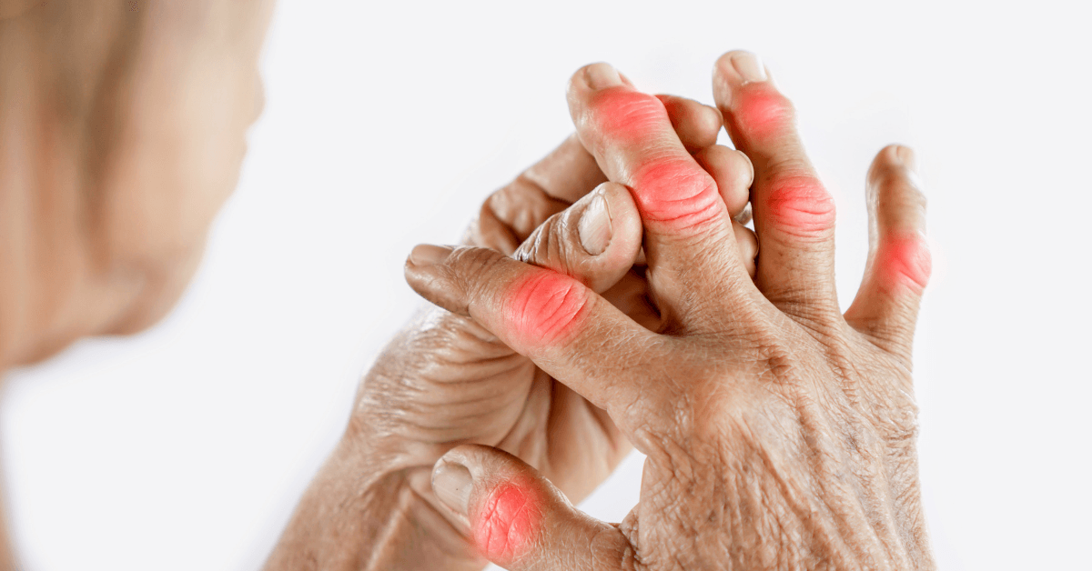 Autoinflammatory Disease