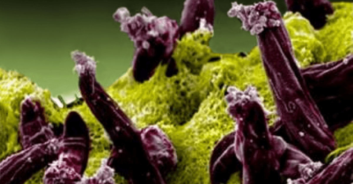 Types of Parasitic STDs